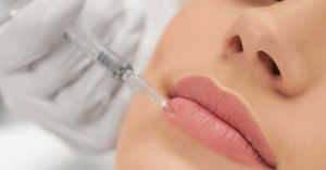 lip fillers